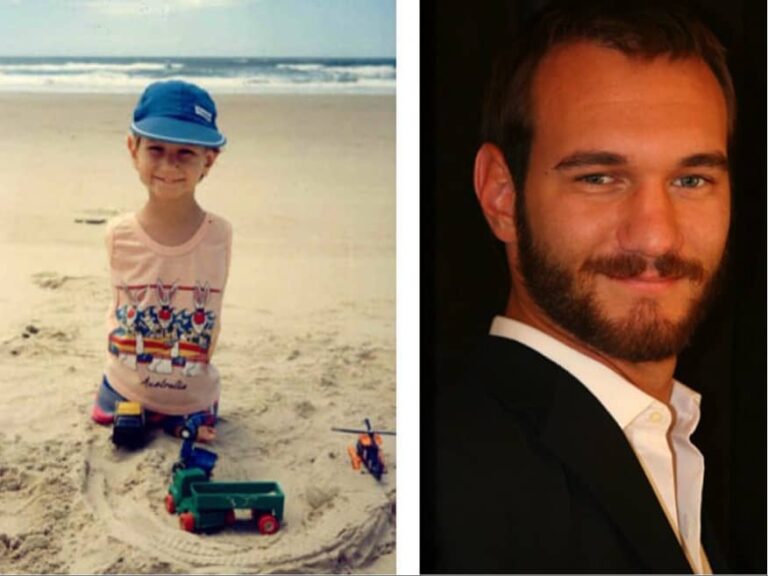 Nick Vujicic Wife Net Worth Family Children Parents Age Height   Nick Vujicic Photo 768x576 